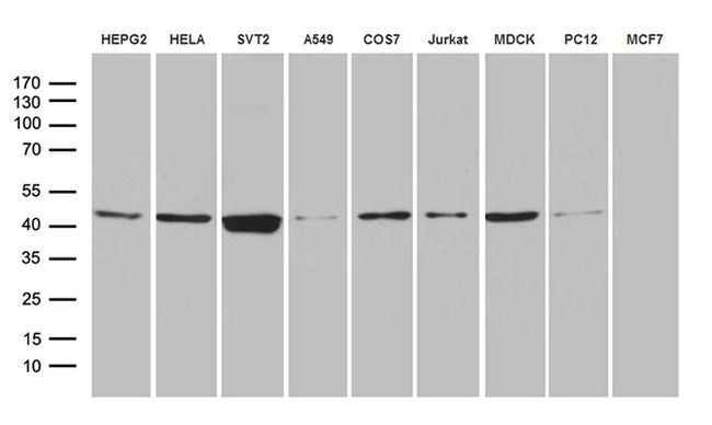 FAM54A Antibody in Western Blot (WB)
