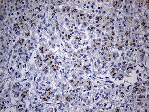 THAP8 Antibody in Immunohistochemistry (Paraffin) (IHC (P))