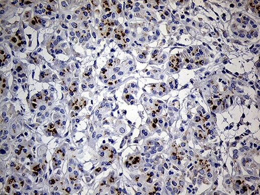 THAP8 Antibody in Immunohistochemistry (Paraffin) (IHC (P))