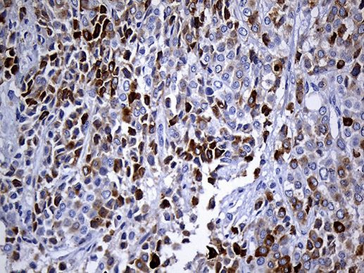 TFF3 Antibody in Immunohistochemistry (Paraffin) (IHC (P))