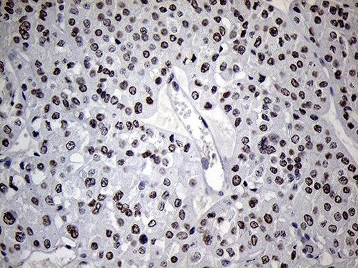 C14orf80 Antibody in Immunohistochemistry (Paraffin) (IHC (P))