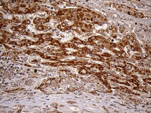 HDHD3 Antibody in Immunohistochemistry (Paraffin) (IHC (P))