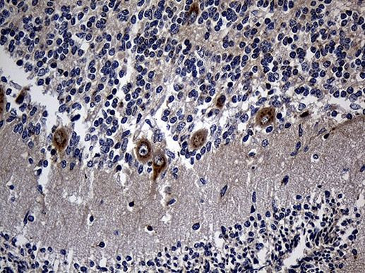 RGMA Antibody in Immunohistochemistry (Paraffin) (IHC (P))