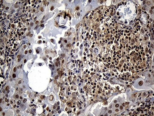 DTWD1 Antibody in Immunohistochemistry (Paraffin) (IHC (P))