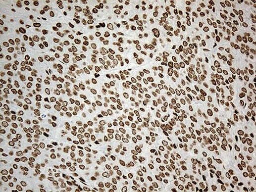 IRF2BP1 Antibody in Immunohistochemistry (Paraffin) (IHC (P))