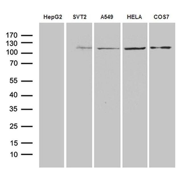 IDE Antibody in Western Blot (WB)