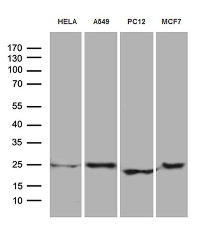 eIF4E3 Antibody in Western Blot (WB)