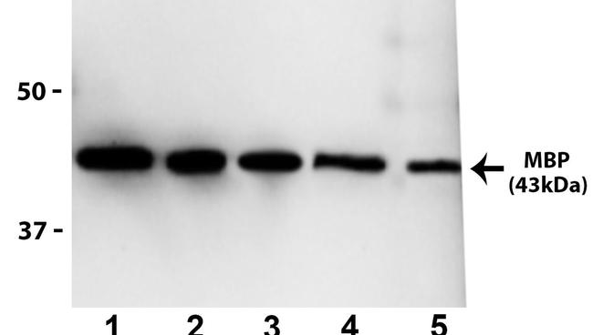 Maltose Binding Protein Antibody in Western Blot (WB)