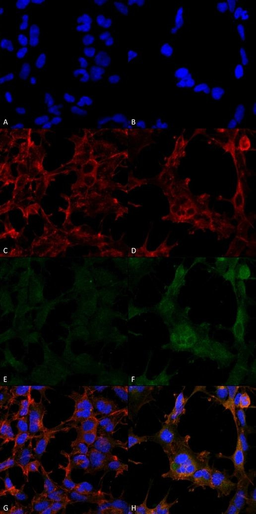 Hexanoyl-Lysine adduct Antibody in Immunocytochemistry (ICC/IF)