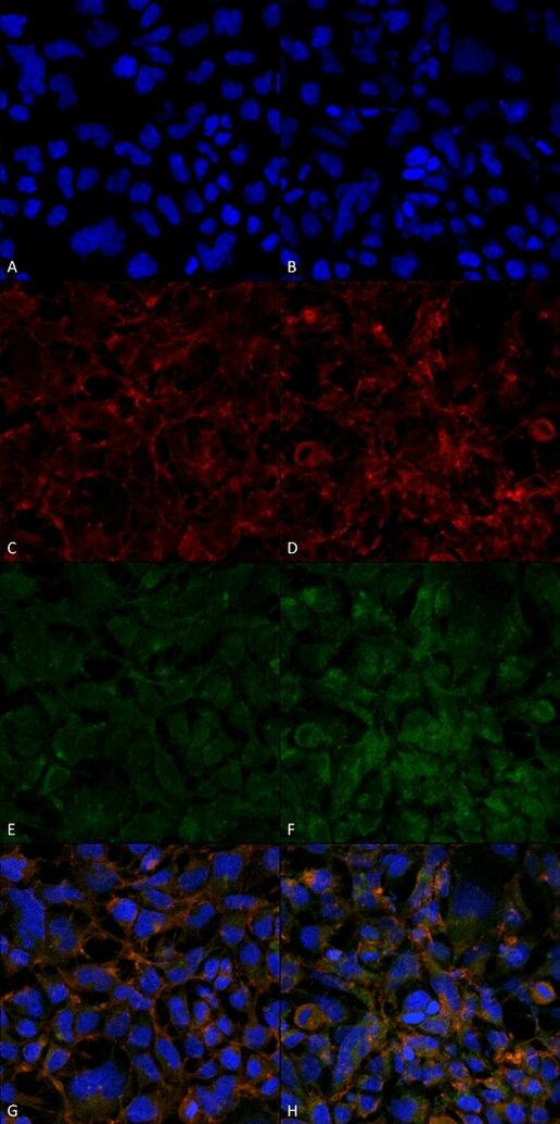 Hexanoyl-Lysine adduct Antibody in Immunocytochemistry (ICC/IF)
