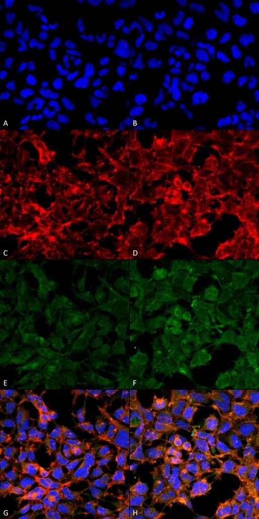 Malondialdehyde Antibody in Immunocytochemistry (ICC/IF)