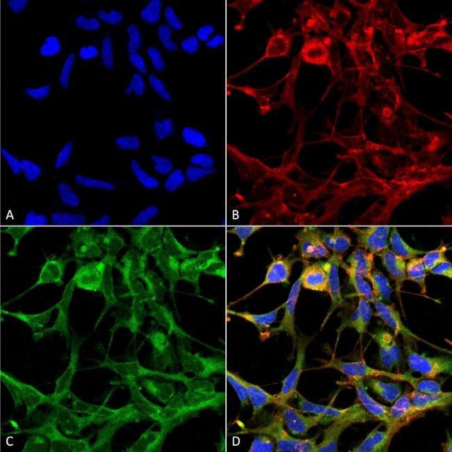 Nitrotryptophan Antibody in Immunocytochemistry (ICC/IF)