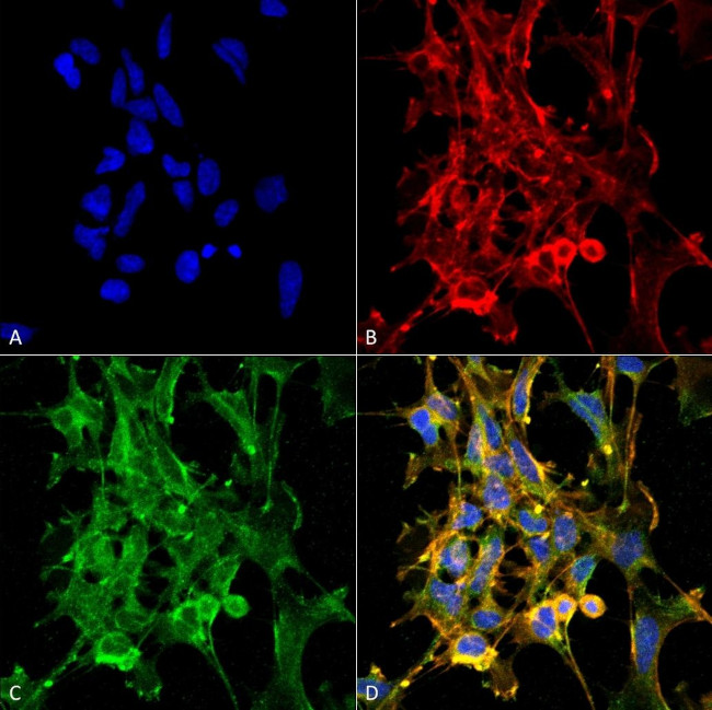 Citrulline Antibody in Immunocytochemistry (ICC/IF)