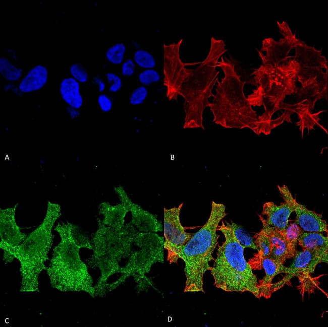 NHLRC1 Antibody in Immunocytochemistry (ICC/IF)