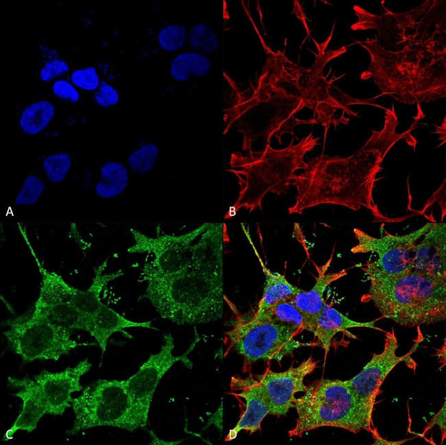 SLC38A1 Antibody in Immunocytochemistry (ICC/IF)