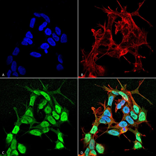 SCN3B Antibody in Immunocytochemistry (ICC/IF)