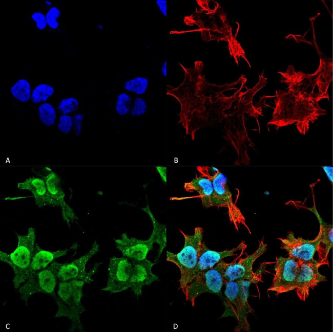 JIP2 Antibody in Immunocytochemistry (ICC/IF)