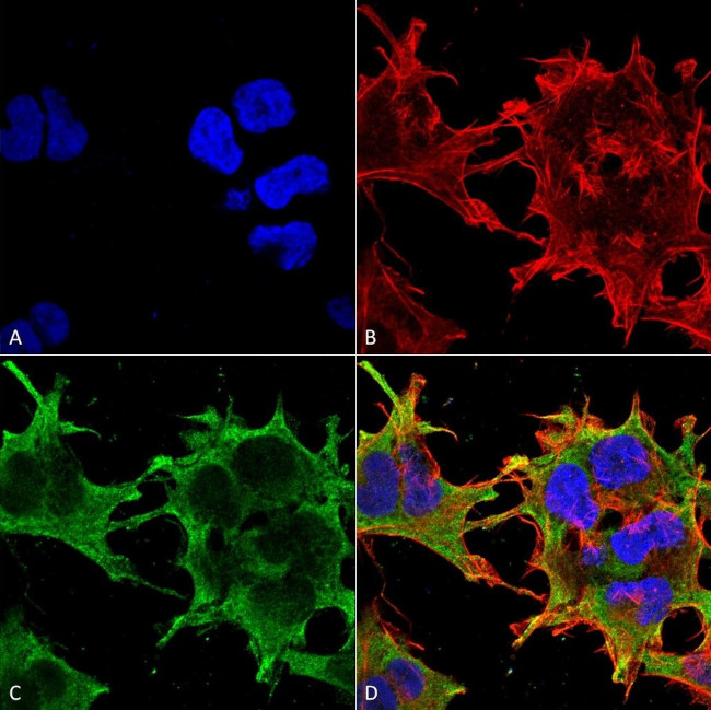 SUR1/SUR2B Antibody in Immunocytochemistry (ICC/IF)