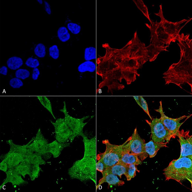 Brevican Antibody in Immunocytochemistry (ICC/IF)