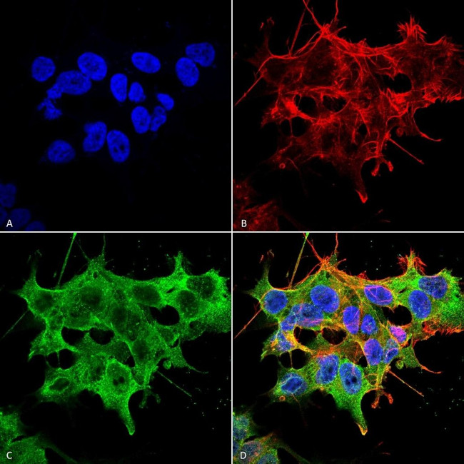Stargazin Antibody in Immunocytochemistry (ICC/IF)