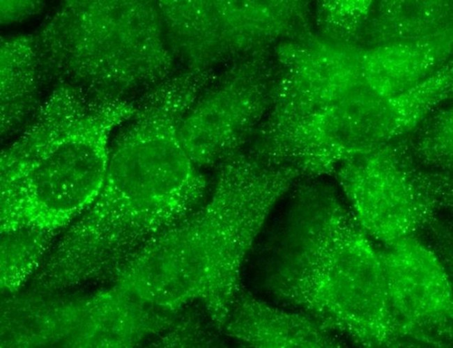 KCNMB2 Antibody in Immunocytochemistry (ICC/IF)
