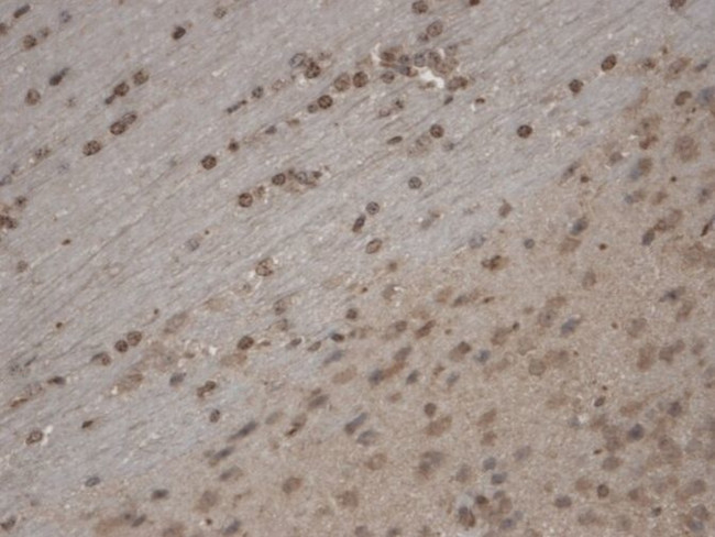 TRPC5 Antibody in Immunohistochemistry (Paraffin) (IHC (P))