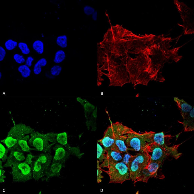 Ataxin 1 Antibody in Immunocytochemistry (ICC/IF)