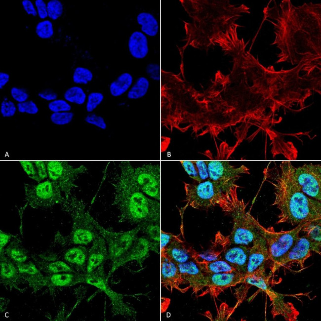 PHYH Antibody in Immunocytochemistry (ICC/IF)