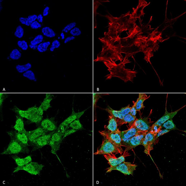 PEX6 Antibody in Immunocytochemistry (ICC/IF)