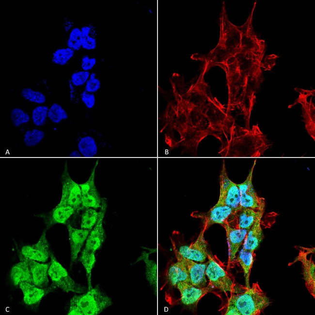 INPP5F Antibody in Immunocytochemistry (ICC/IF)