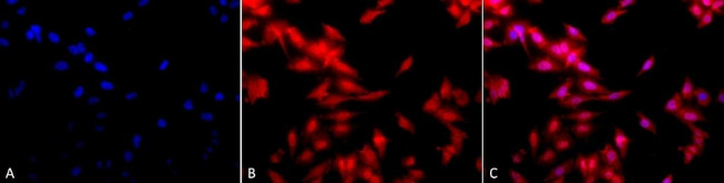 HSF1 Antibody in Immunocytochemistry (ICC/IF)