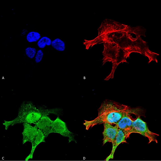 GRK5 Antibody in Immunocytochemistry (ICC/IF)