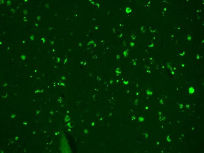 CACNB1 Antibody in Immunohistochemistry (Paraffin) (IHC (P))