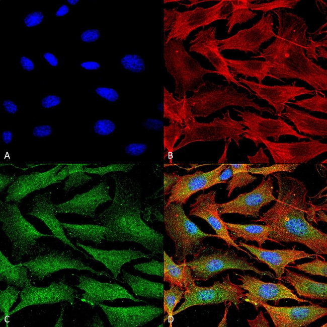 ATP7A Antibody in Immunocytochemistry (ICC/IF)