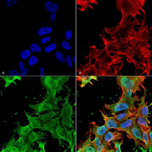 alpha-2c Adrenergic Receptor Antibody in Immunocytochemistry (ICC/IF)