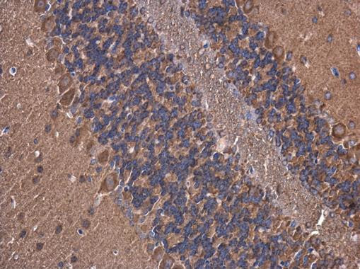ATP6V1A Antibody in Immunohistochemistry (Paraffin) (IHC (P))