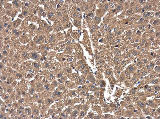 Cofilin Antibody in Immunohistochemistry (Paraffin) (IHC (P))