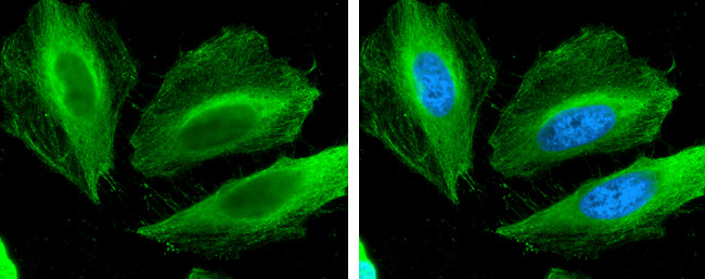 Filamin B Antibody in Immunocytochemistry (ICC/IF)
