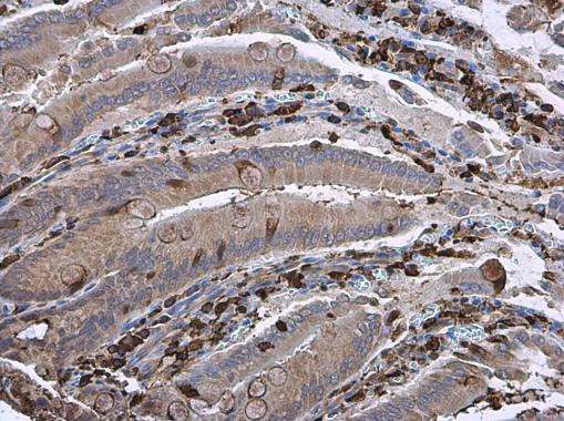 Gelsolin Antibody in Immunohistochemistry (Paraffin) (IHC (P))
