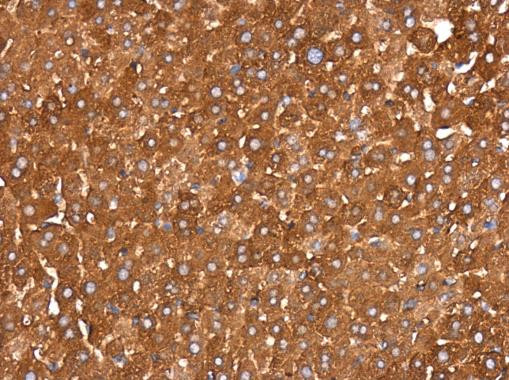 IDE Antibody in Immunohistochemistry (Paraffin) (IHC (P))