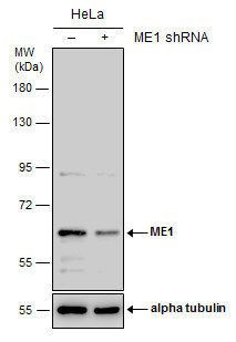 ME1 Antibody in Western Blot (WB)