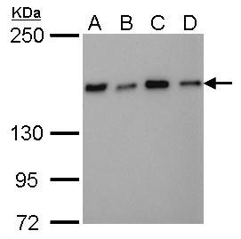 NFKBIL2 Antibody in Western Blot (WB)