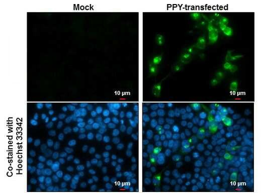 PPY Antibody in Immunocytochemistry (ICC/IF)