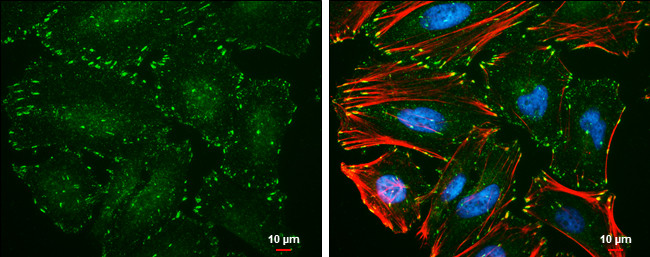 Phospho-Paxillin (Tyr118) Antibody in Immunocytochemistry (ICC/IF)