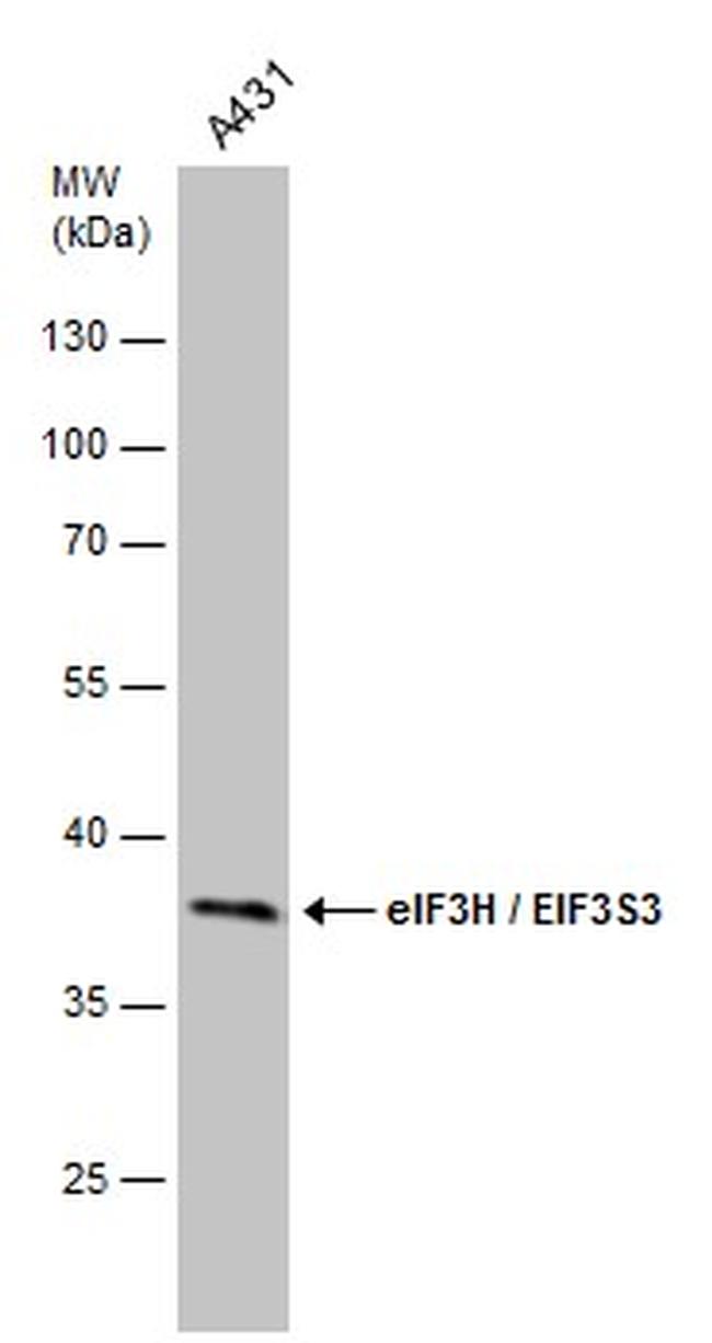 eIF3h Antibody in Western Blot (WB)