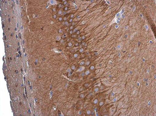 GEF-H1 Antibody in Immunohistochemistry (Paraffin) (IHC (P))