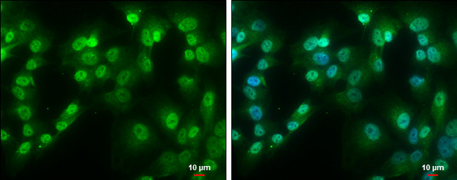 QKI Antibody in Immunocytochemistry (ICC/IF)