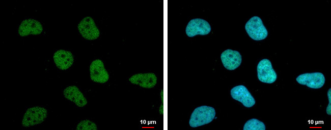 STAG1 Antibody in Immunocytochemistry (ICC/IF)