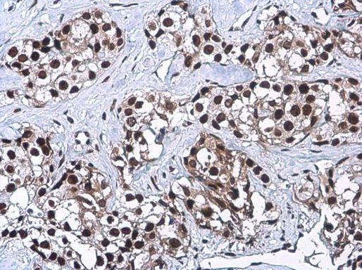 CFDP1 Antibody in Immunohistochemistry (Paraffin) (IHC (P))