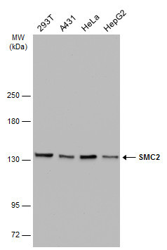 SMC2 Antibody in Western Blot (WB)